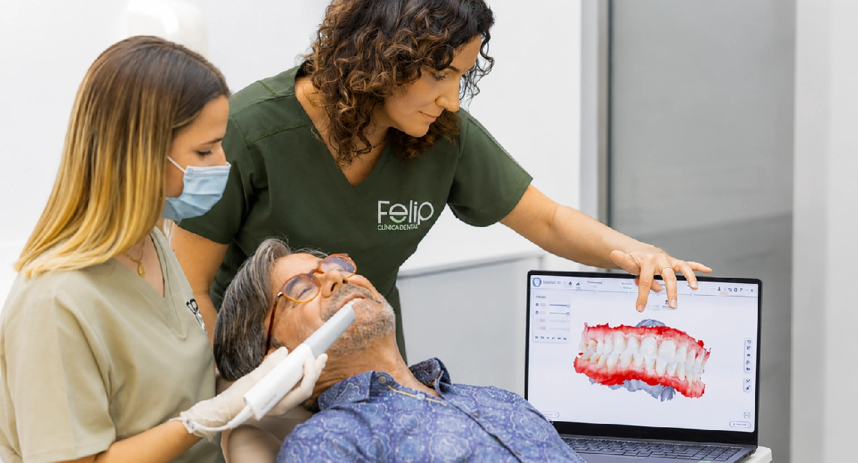 Implantes-dentales-algemesi