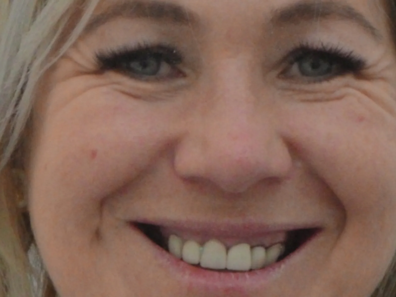 Sonrisa antes de un tratamiento de estética dental en Algemesí
